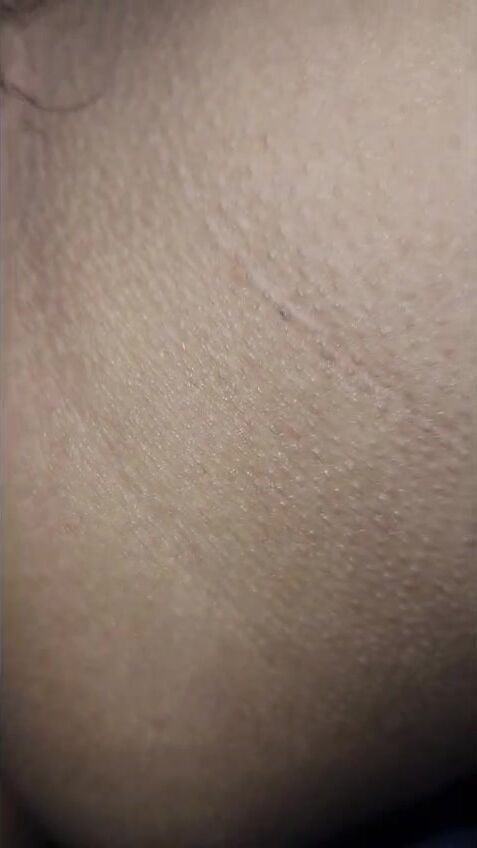 Móc lồn tơ chảy nước